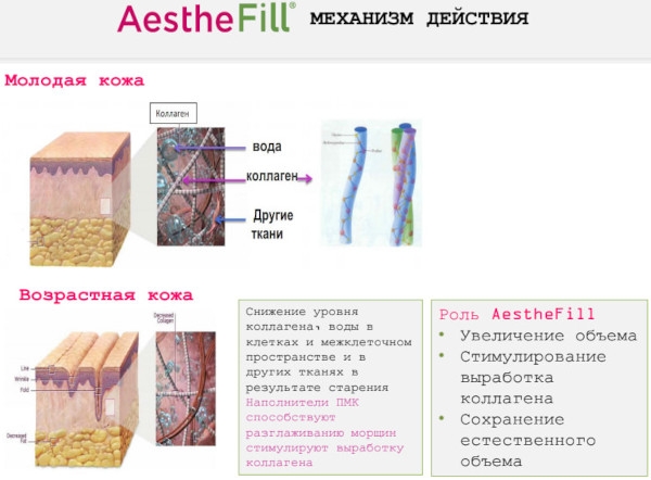 Aesthefill (Эстефил) препарат-филлер. Отзывы, цена
