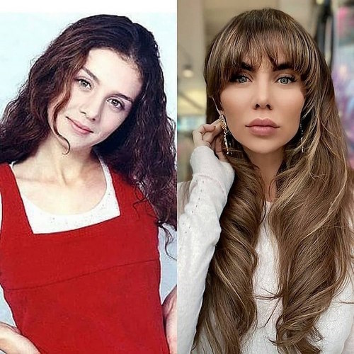 Анна Седокова до и после пластики. Что изменила, фото, биография