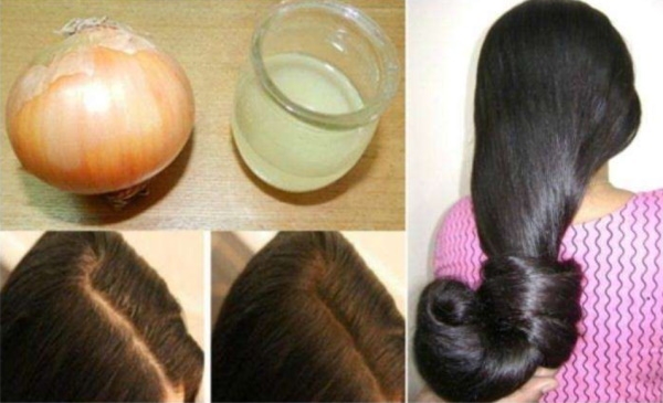 Укрепление корней волос при выпадении. Лучшее средство, как укрепить корни